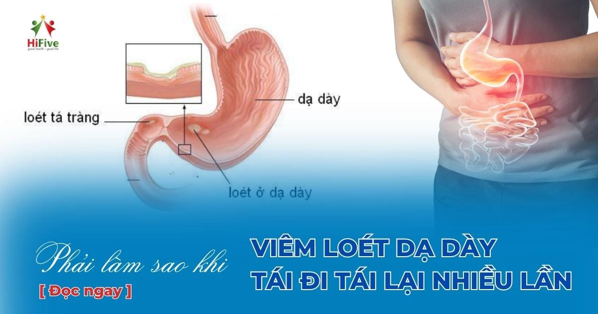 viem-loet-da-day-tai-di-tai-lai-nhieu-lan