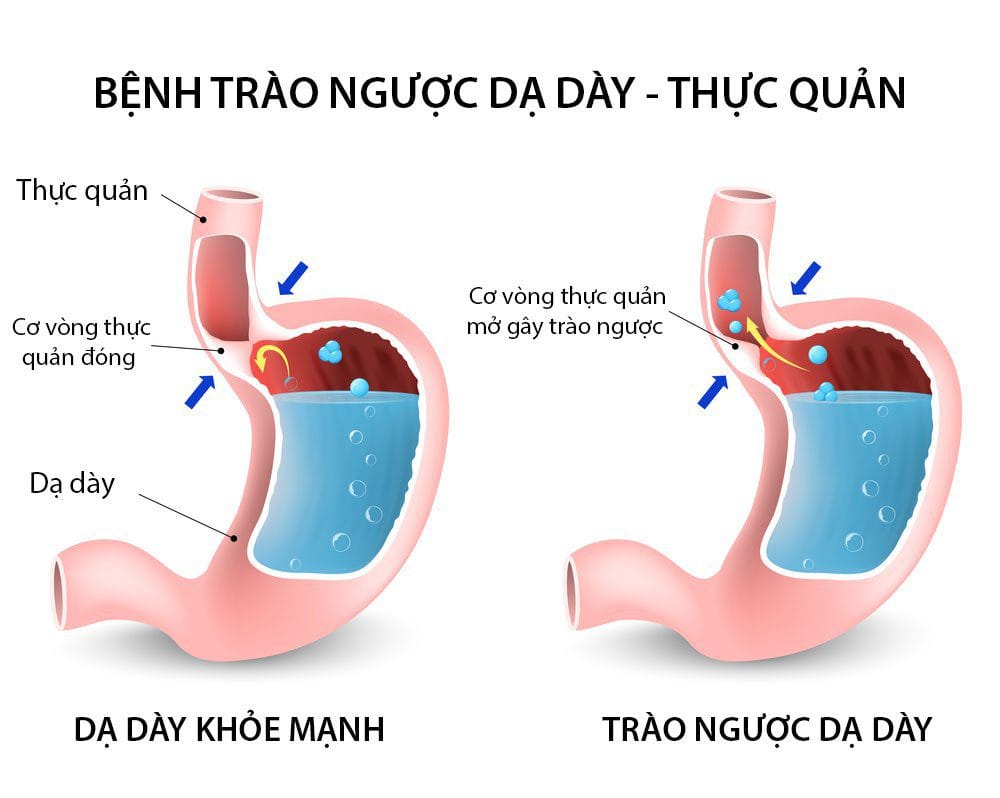 bieu-hien-cua-trao-nguoc-da-day-thuc-quan
