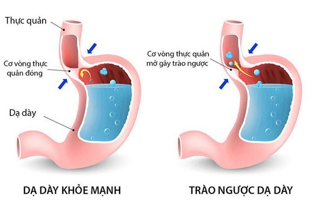 bieu-hien-cua-trao-nguoc-da-day-thuc-quan